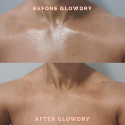 GlowDry™ Starter Kit - Image 2